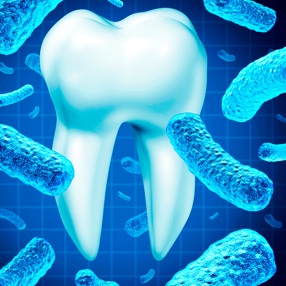 Centro de Medicina Periodontal - Prof Adj Dr Jorge Gabito Mira - DAM –  dispositivo de avance mandibular es un sistema bucal intra-oral para el  tratamiento de la roncopatía y la apnea