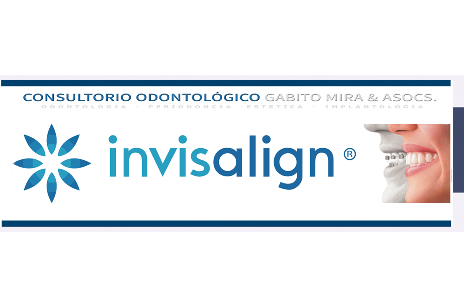 Invisalign Banner